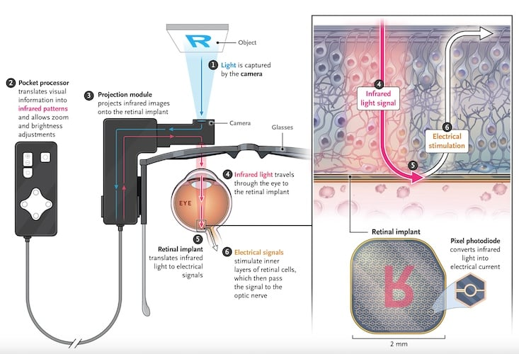 Path of visual information through the PRIMA system. 